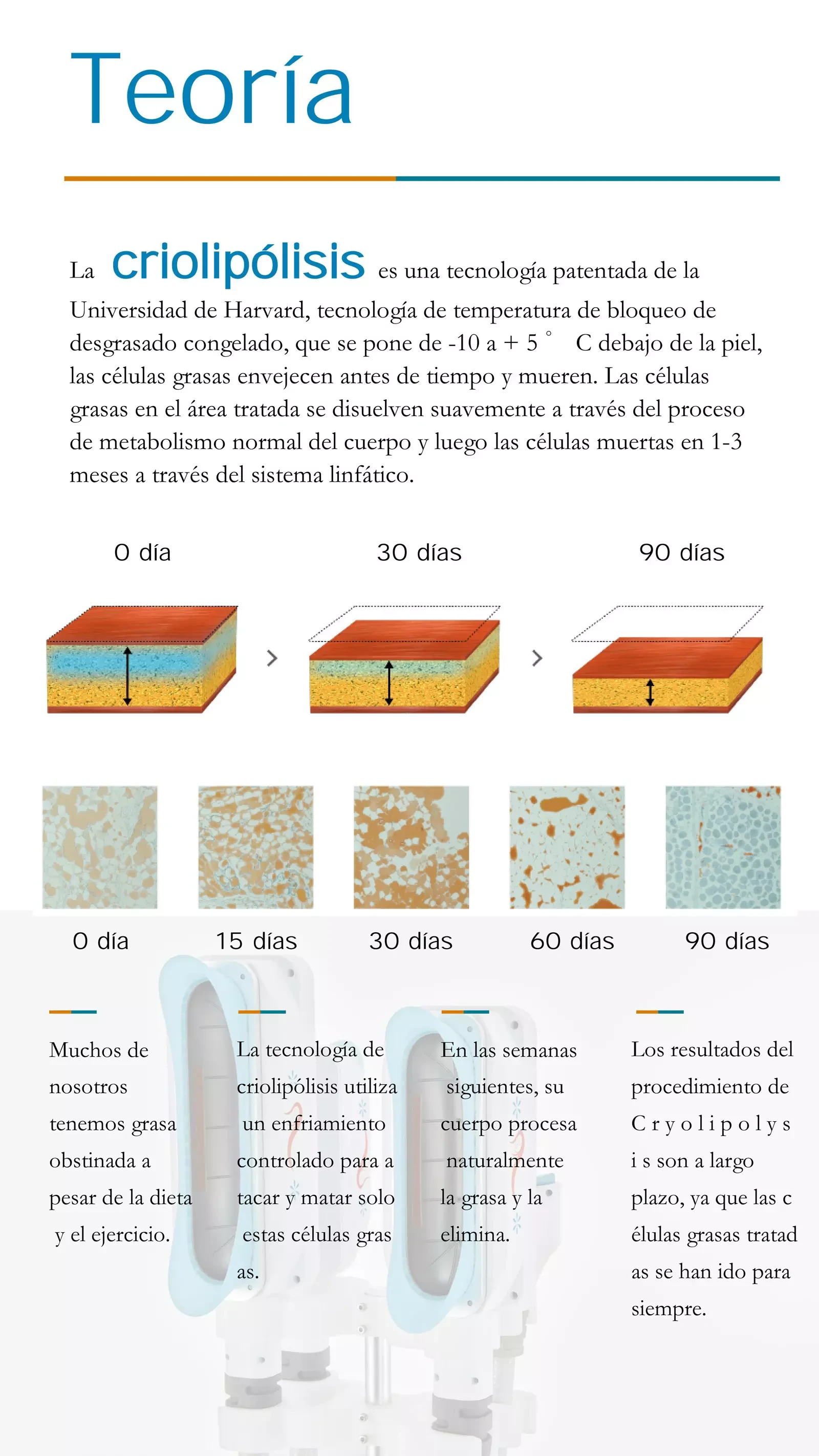 Criolipolisis Maquina PDF Download