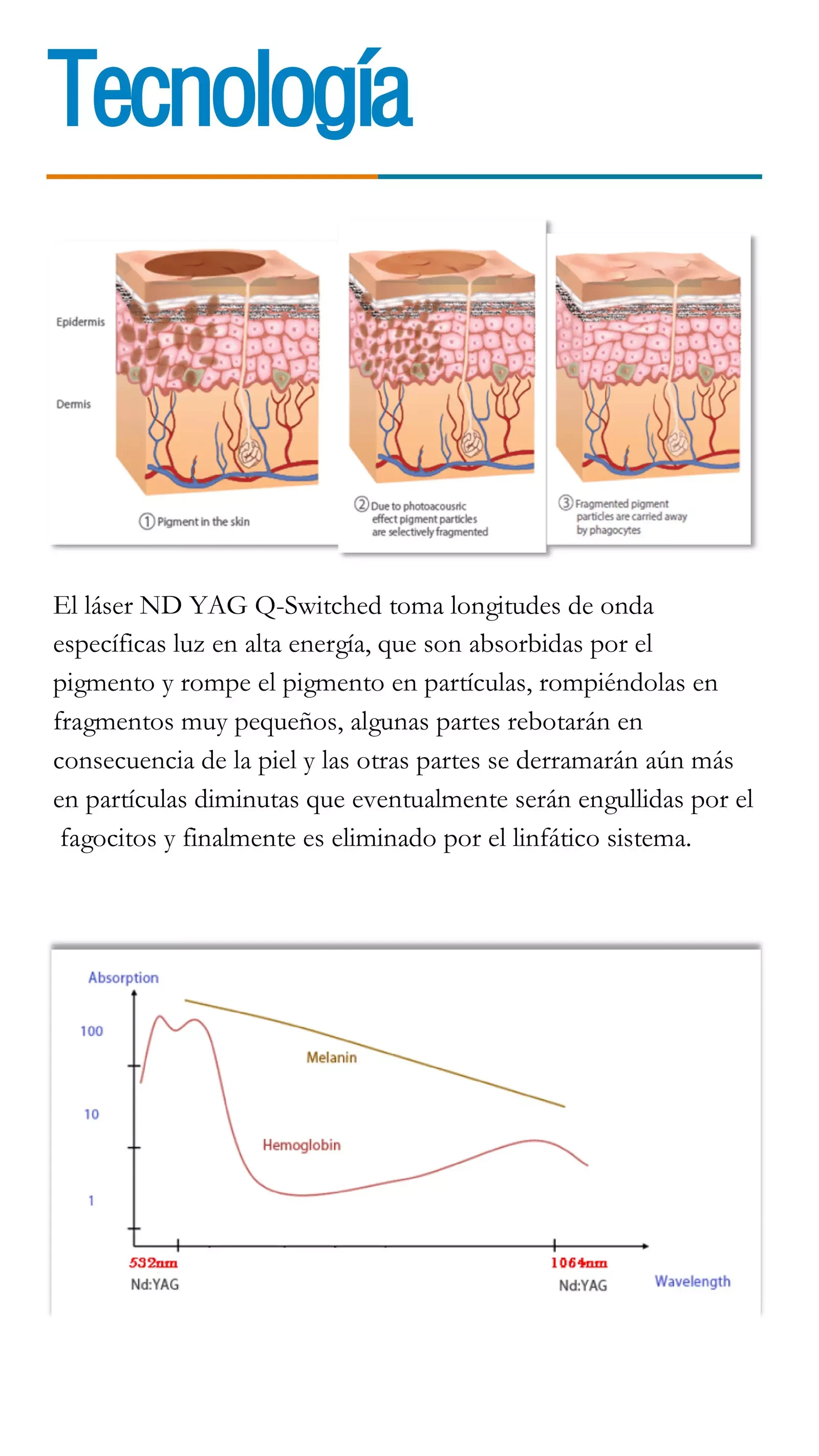 Máquinas de eliminación de Tatuajes PDF Download