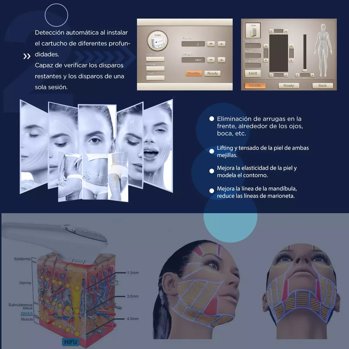 La Máquina HIFU de Belleza Para Antiedad