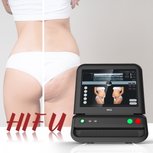 La Maquina de HIFU Para Adelgazar Cara y Cuerpo