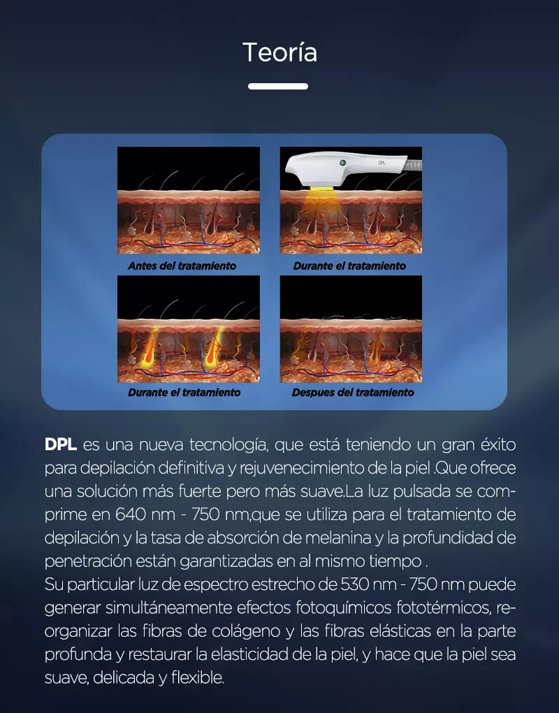 Máquina De Rejuvenecimiento Depilación De DPL Máquina De Rejuvenecimiento Depilación De DPL